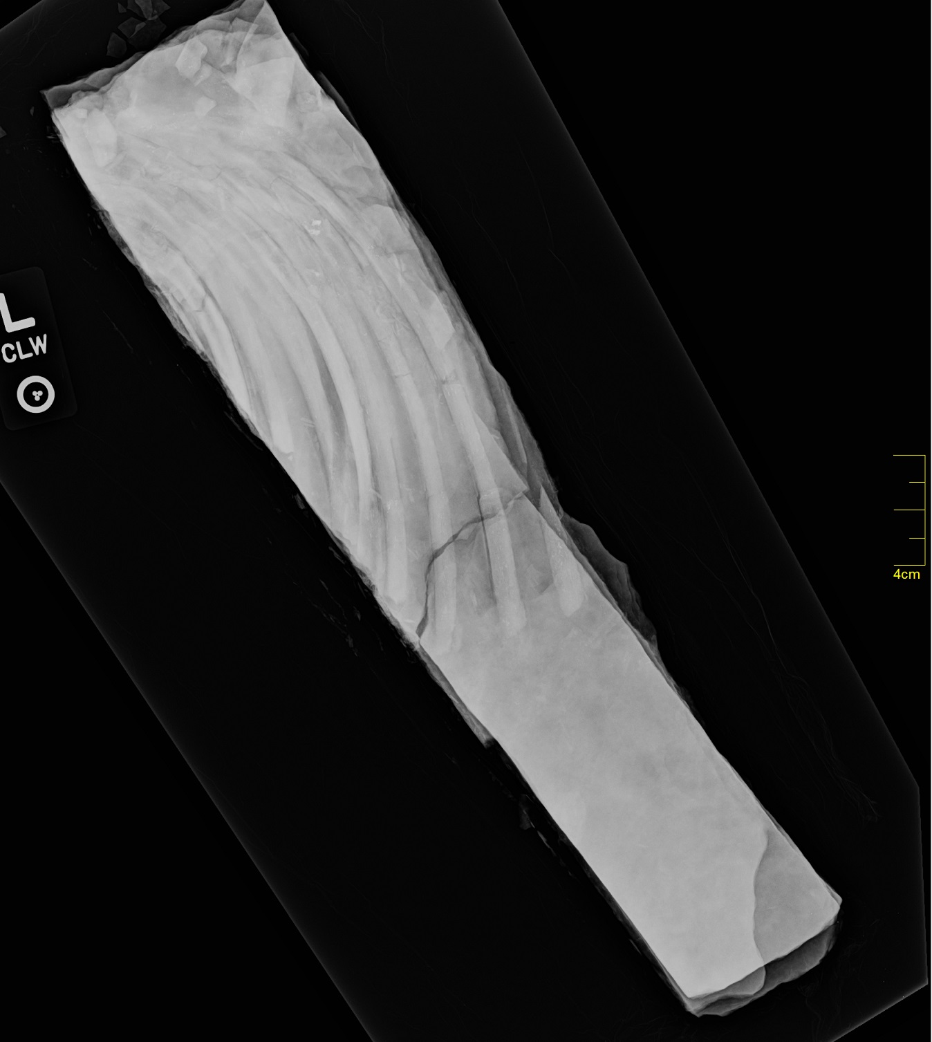 Tapiromorph rib cage in X-ray